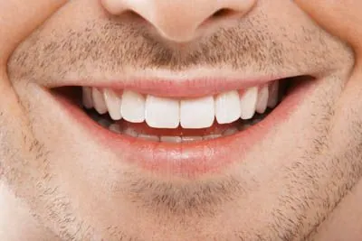 closeup of a man's smile after cosmetic dentistry care at Dat Complete Dentistry