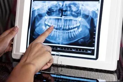 X-ray of patient's teeth