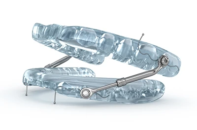 dental appliances for sleep apnea provided by Dat Complete Dentistry